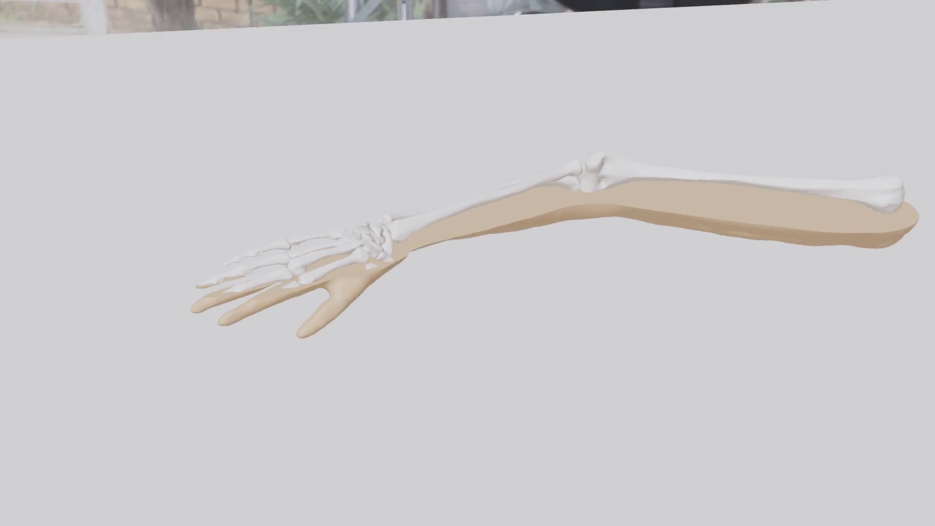 Fracture Immobilisation Trainer Robotic Arm with Haptic Feedback